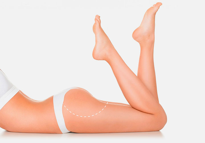 vacumterapia-tsunagari-monterrey